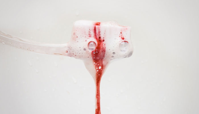 Chảy máu chân răng: nguyên nhân và cách khắc phục